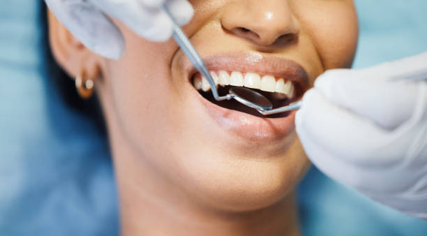 Best Emergency Root Canal Treatment in Union, MS